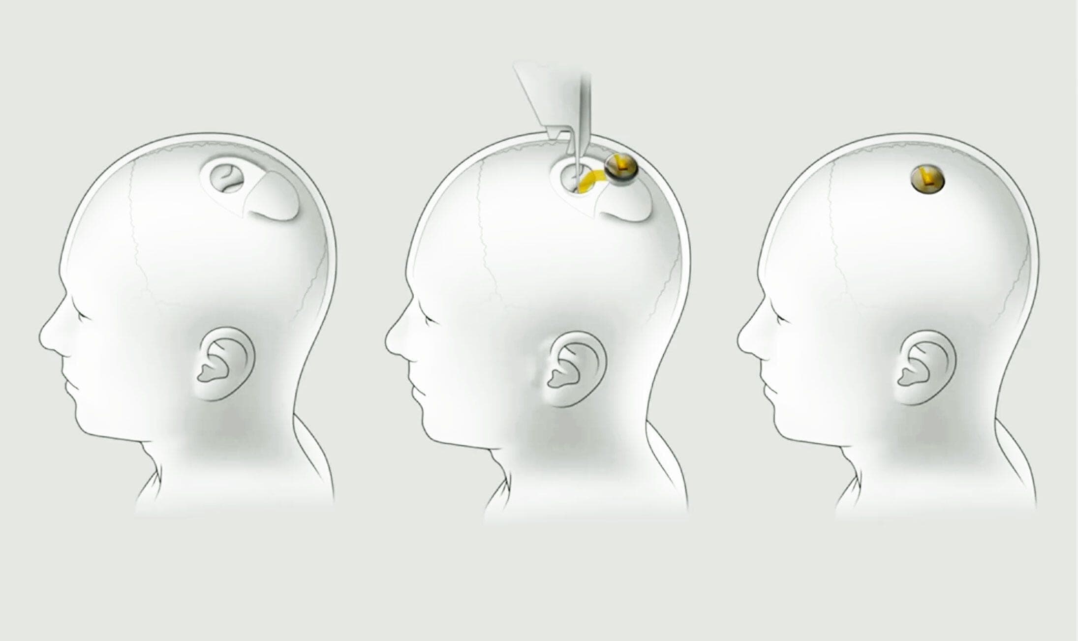 image post